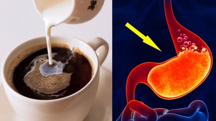 Does Coffee Cause Gastritis