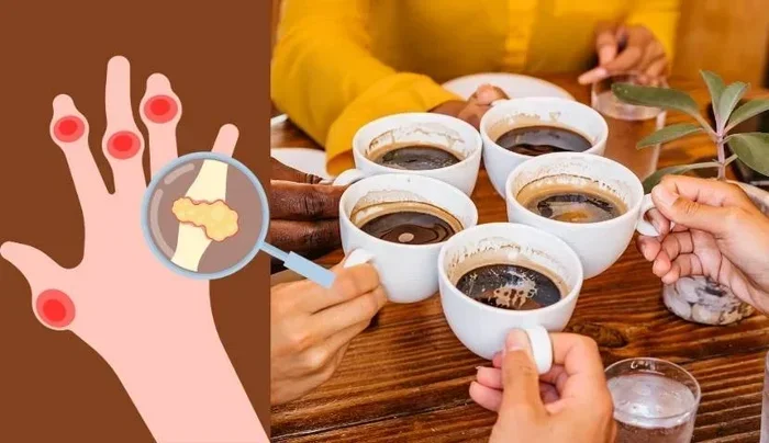 Can Coffee Cause Gout