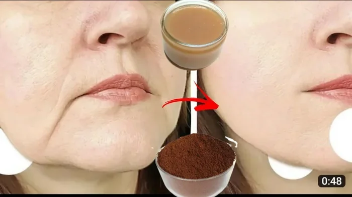 Can You Have Coffee Before Botox
