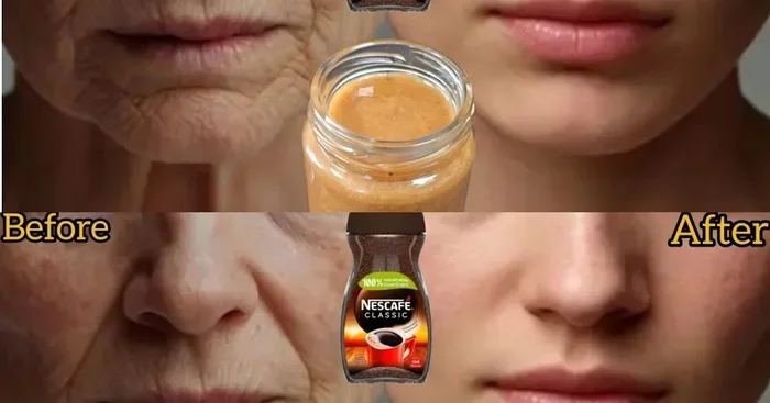 Can You Have Coffee Before Botox