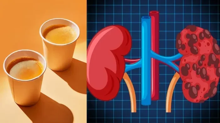 Does Coffee Damage Kidneys