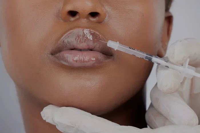 Can I Drink Coffee After Lip Filler