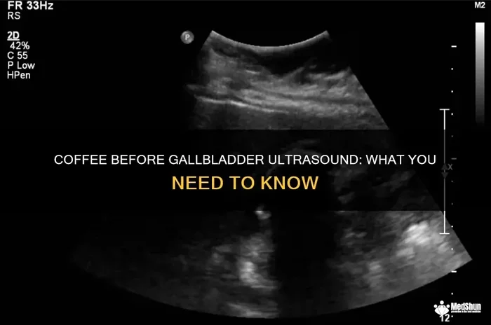 Can I Drink Coffee Before an Abdominal Ultrasound